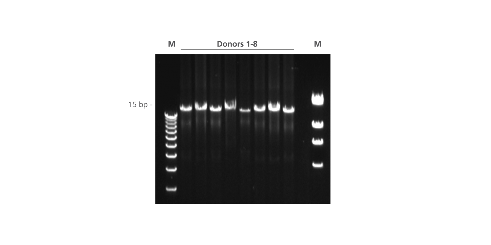 Amplification of a 15 kb fragment of the human coagulation factor IX gene, using 250 ng DNA isolated from 8 blood donors using the PAXgene Blood DNA System as starting material. M: markers.