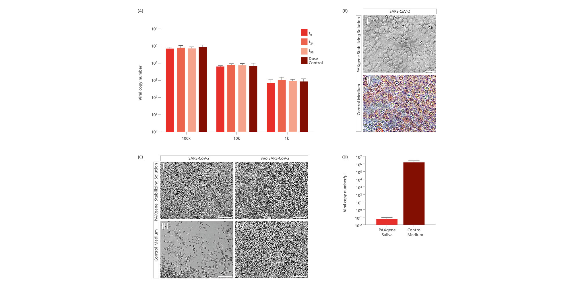 A. Quantification of SARS-CoV-2 derived RNA after stabilization of infectious saliva in the PAXgene Saliva Collector. 2 ml saliva were spiked with 1,000, 10,000 or 100,000 viral copies and stabilized with PAXgene Saliva stabilizing solution. Viral RNA was isolated 0, 24 and 96 h after spike-in using QIAamp Viral RNA Mini Kit and quantified using QuantiTect Multiplex RT-PCR Kit and CDC primer pair N1 on Rotor-Gene Q. Experiments were performed in four biological replicates with three technical replicates each; data is presented as mean ± SD. B. Immunohistochemical staining of Coronavirus Nucleocapsid 24 h after infection of Vero cells with SARS-CoV-2 in PAXgene Saliva stabilizing solution (upper panel) and SARS-CoV-2 in control medium (lower panel). Scale bar represents 50 µm. C. Micrographs showing Vero cells 72 h past infection in four conditions. (I) Viable Vero Cells after treatment with SARS-CoV-2 spiked in stabilizing solution; (II) Viable Vero Cells when treated with stabilizing solution without SARS-CoV-2 spike-in; (III) Apoptotic, detached Vero Cells which were treated with medium containing SARS-CoV-2. Cells show clear cytopathic effects due to virus infection; (IV) Vero Cells were treated with pure medium. Scale bar represents 250 µm. D. SARS-CoV-2 derived RNA in the supernatant 72 h after infection reduced by 7 log10 in Condition I in comparison to Condition IV. Viral RNA was isolated with QIAamp Viral RNA Mini Kit and quantified on Rotor-Gene Q. Experiments were performed in three biological replicates with three technical replicates each; data is presented as mean ± SD.