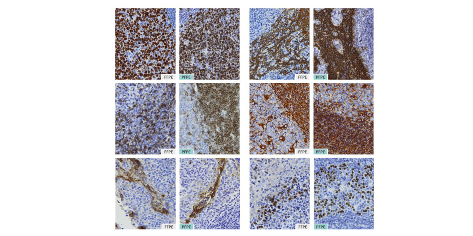Human palatine tonsil tissue was fixed in PAXgene Tissue FIX or with neutral-buffered formalin and embedded in paraffin. Primary antibodies to the indicated antigens were linked to a streptavidin-peroxidase conjugate by a biotinylated secondary antibody (LSAB method). Sections were counterstained with hematoxylin. PFPE: PAXgene Tissue-fixed, paraffin-embedded; FFPE: formalin-fixed, paraffin-embedded.