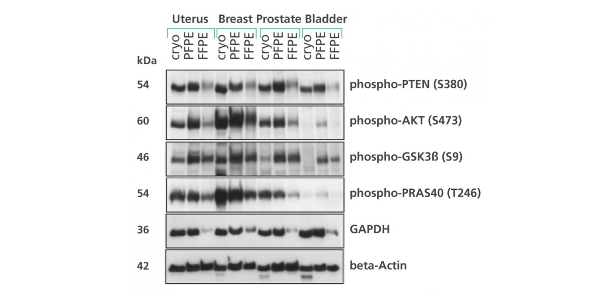 Non-malignant human uterus, breast, prostate and bladder specimens were divided into 3 samples and either flash-frozen in liquid nitrogen (cryo), PAXgene Tissue-fixed, paraffin-embedded (PFPE) or formalin-fixed, paraffin-embedded (FFPE). Proteins from cryo, PFPE, and FFPE tissues were extracted using the extraction buffer EXB Plus (Qproteome FFPE Tissue Kit; described in Ergin et al. 2010, Gündisch et al. 2013 and PAXgene Tissue supplementary protocols). SDS-PAGE and Western blot analysis were performed with 15 μg protein and the indicated antibodies. Data kindly provided by Karl-Friedrich Becker, Technical University of Munich, Germany.